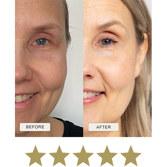 i_NaturalMagic_Before_After_Teija_FI_2025_withstars