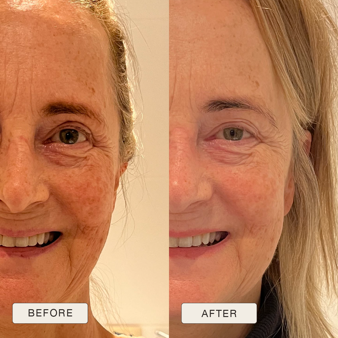 i_NaturalMagic_Before_After_Helga_2025