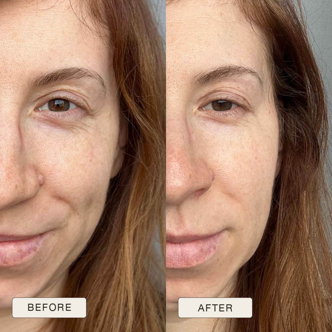 i_NaturalMagic_Before_After_Patryija_PL_2025