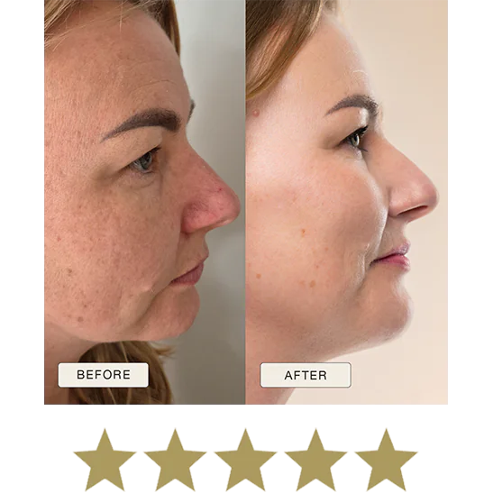 i_NaturalMagic_Before_After_Beata_PL_2025_withstars