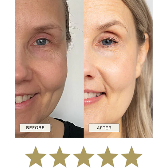 i_NaturalMagic_Before_After_Teija_FI_2025_withstars