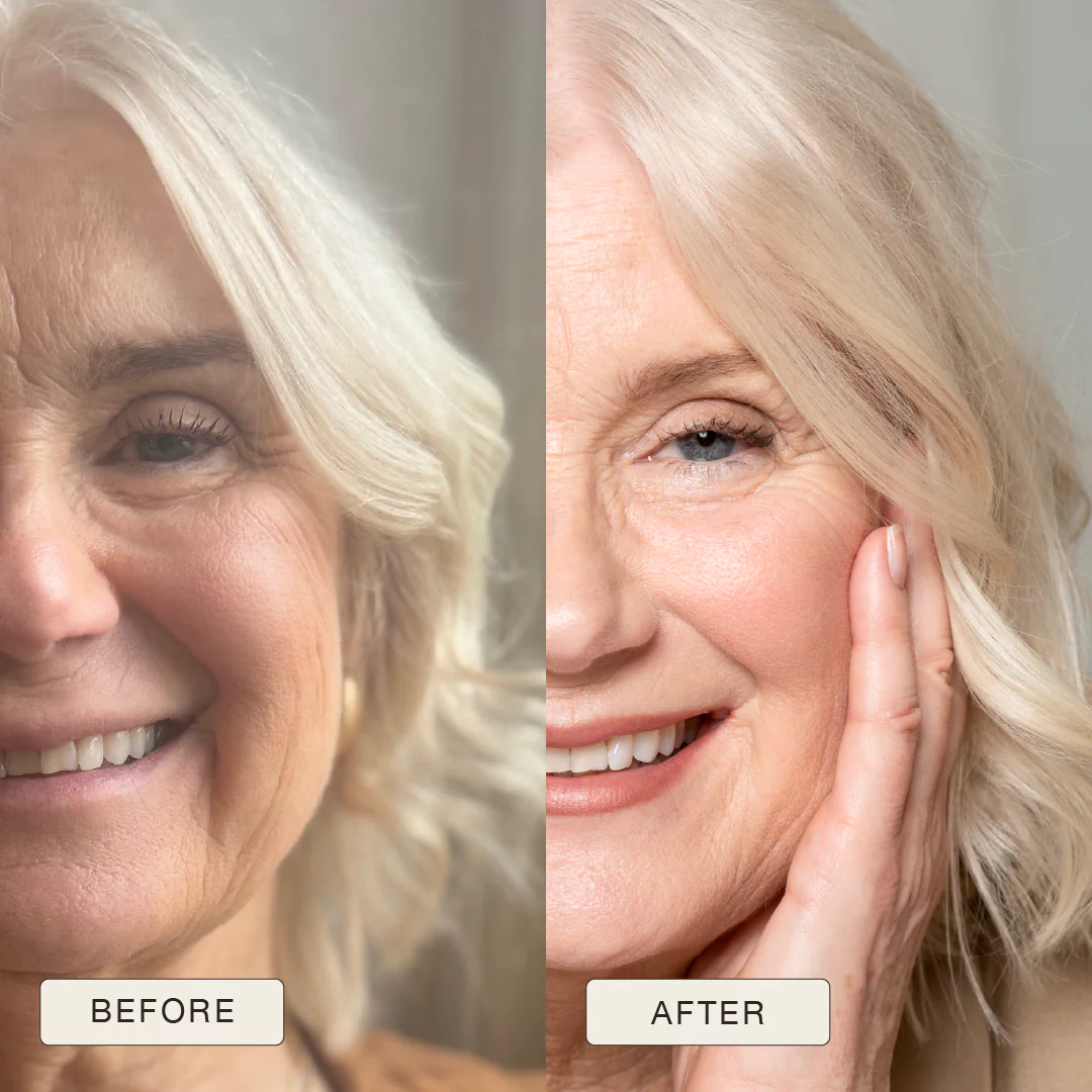 i_NaturalMagic_Before_After_Anna_2025-10